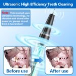 Dog Plaque Remover for Teeth,Pet Ultrasonic Tooth Cleaner,Teeth Cleaning Kit -Tartar Remover for Teeth Stains for Dogs and Cats (Black) - Image 4