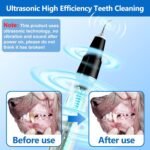 Plaque Remover for Teeth - Pet Ultrasonic Cleaner - Teeth Cleaning Kit for Tartar and Stains - Suitable for Dogs and Cats (Black) - Image 4